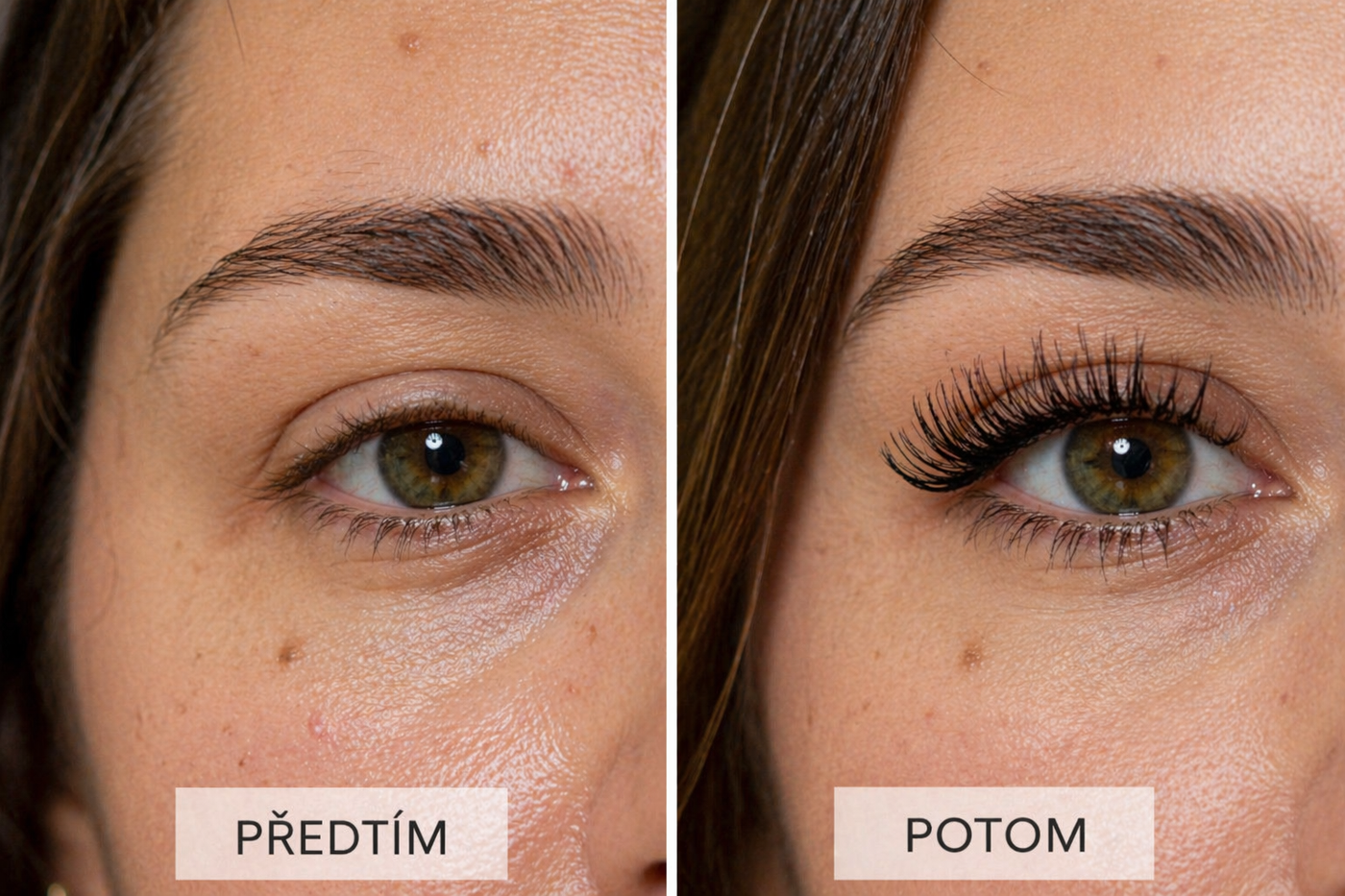 💜Přirozený rozdíl, který uvidíš